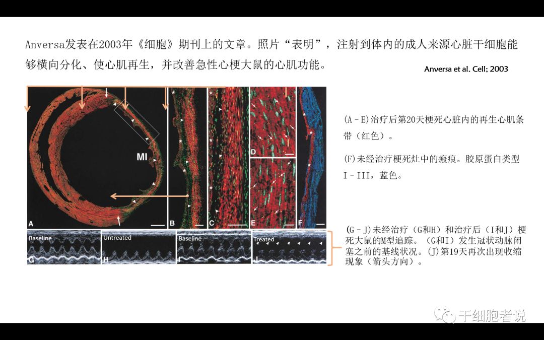干货：干细胞治疗心血管疾病的未来（PPT）