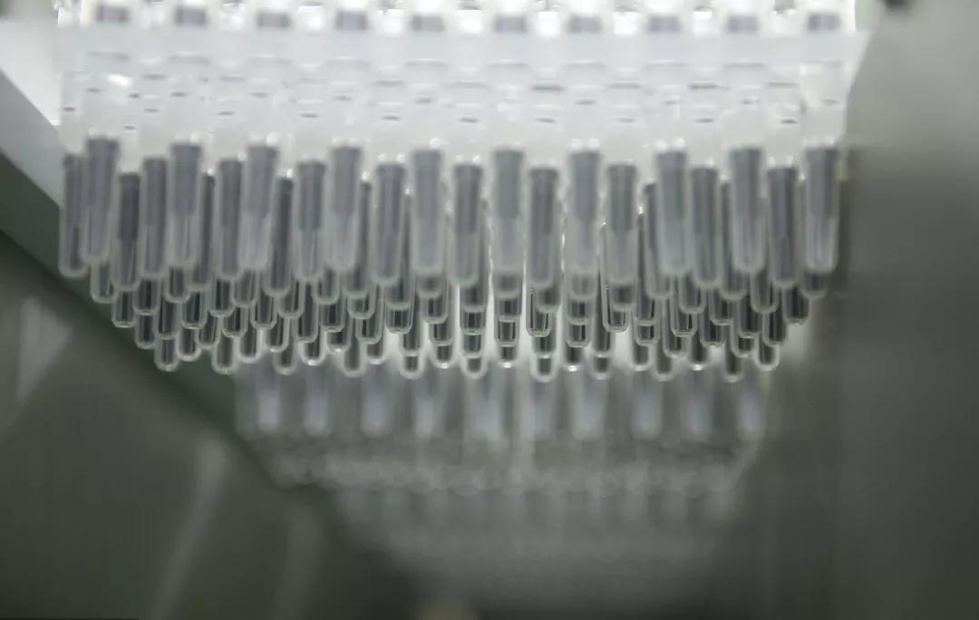 最近的年轻人不敢看体检报告,千万不要去做体检报告