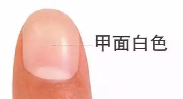 科普|指甲的态势反映了你身体的状况