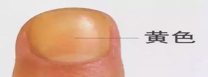 科普|指甲的态势反映了你身体的状况
