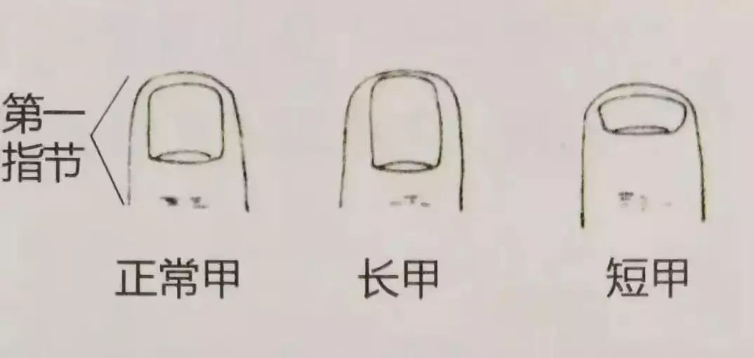 科普|指甲的态势反映了你身体的状况