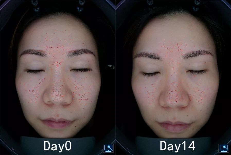 盲测|微整不急!先试试黑科技抗老面霜