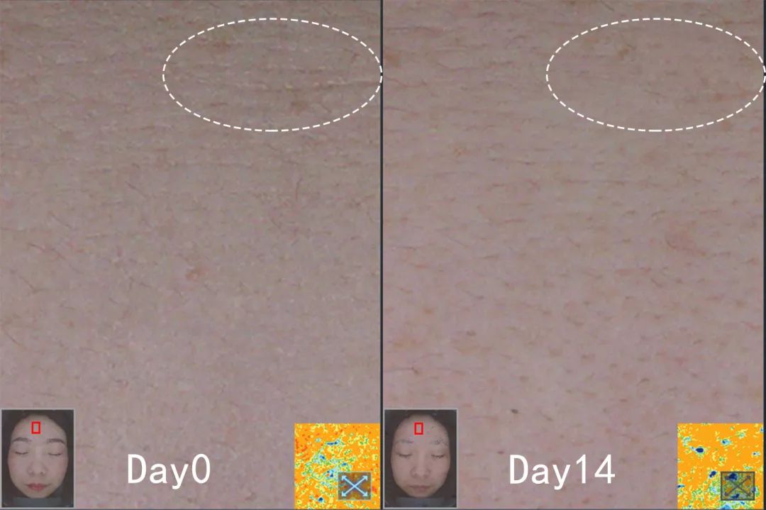 盲测|微整不急!先试试黑科技抗老面霜