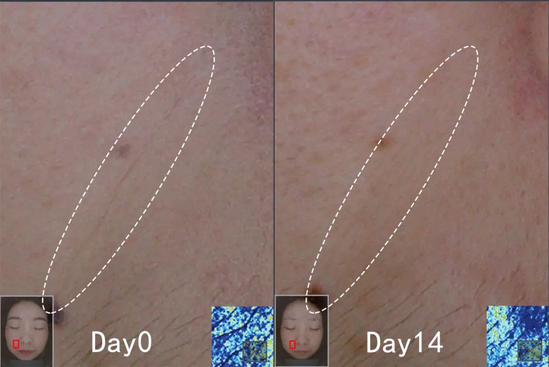 盲测|微整不急!先试试黑科技抗老面霜