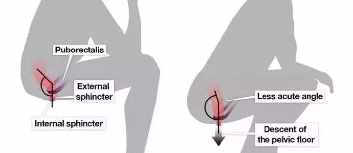长时间在厕所蹲着有什么影响,厕所蹲太久会造成什么后果