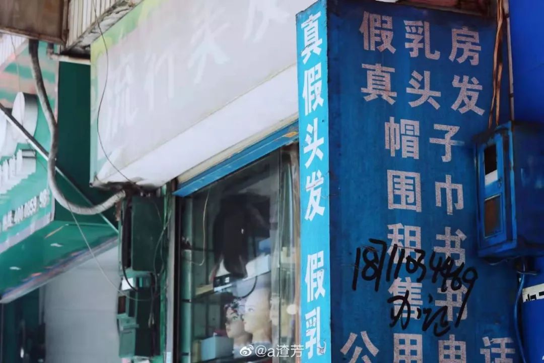 癌症患者挂尿袋和屎袋,患癌人身上带着尿袋