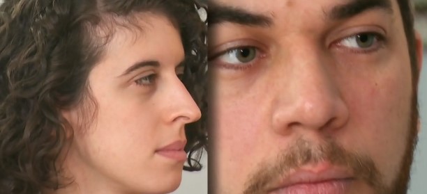 多名加拿大人做完近视手术受剧痛折磨想自杀