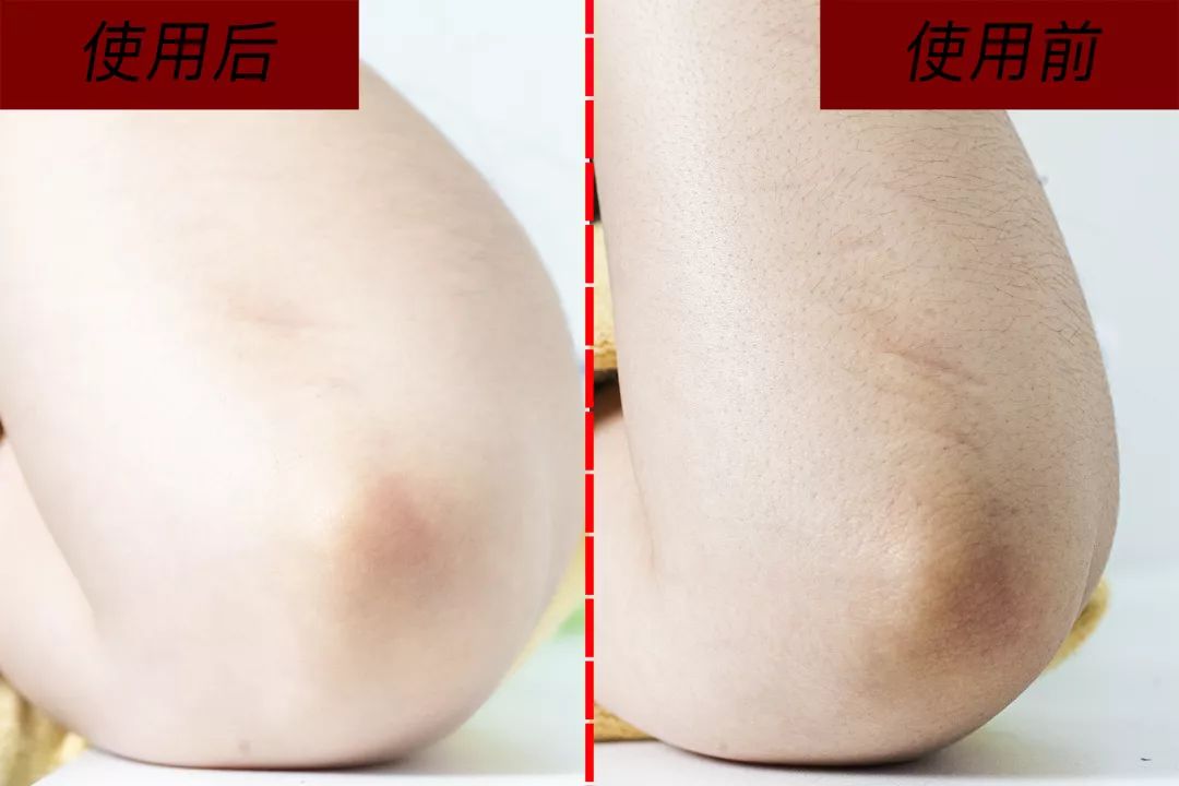 男士脸爆皮用什么保湿,男生秋冬脸上起皮用什么保湿