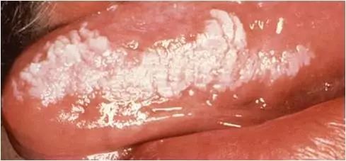 慧眼识“艾”情，让您见识牙医的“另一面”