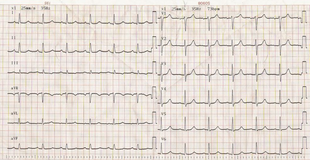 致命胸痛的10个常见部位,致命性胸痛的常见病因有哪些