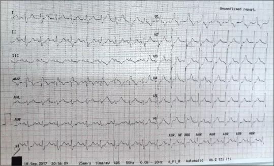 致命胸痛的10个常见部位,致命性胸痛的常见病因有哪些