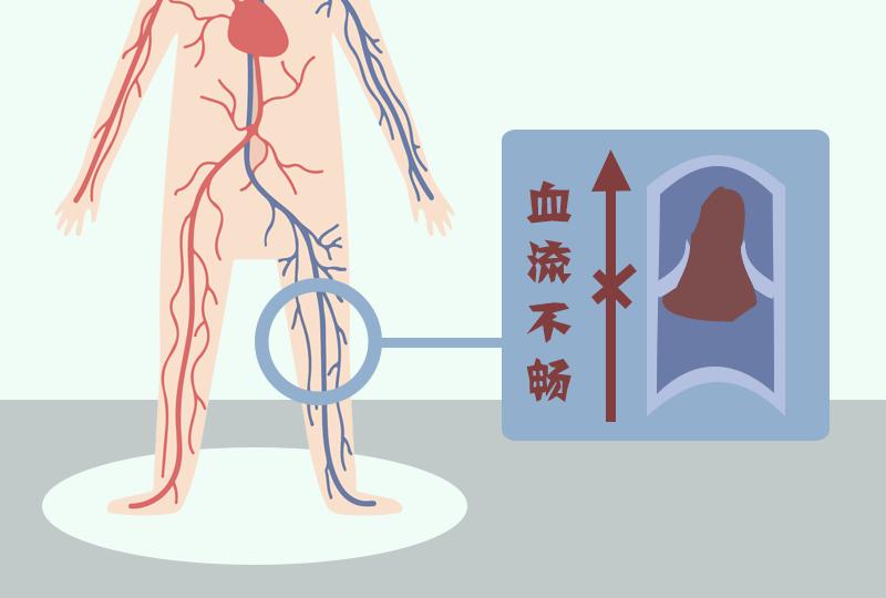 辟谣特工队|坚果是天然“血管清道夫”？言过其实了