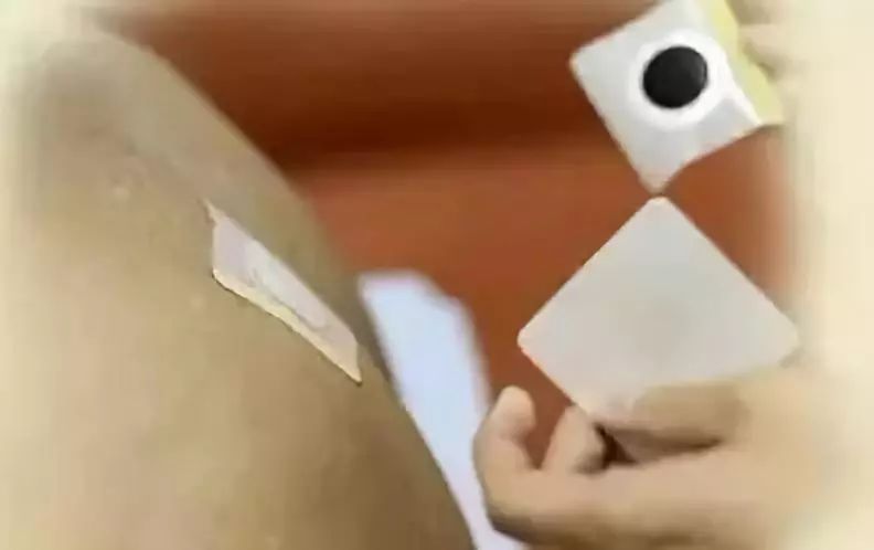 周知！鄂尔多斯市中心医院“特色三九贴”12月21日开始贴敷