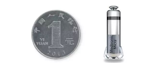 华西医院无导线心脏起搏器多少钱,人工心脏植入四川首例