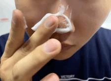 脸上搓下来很多泥,脸上搓出黑头