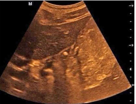 学生一吃饭胃疼怎么办,学生在学校吃什么会导致胃疼