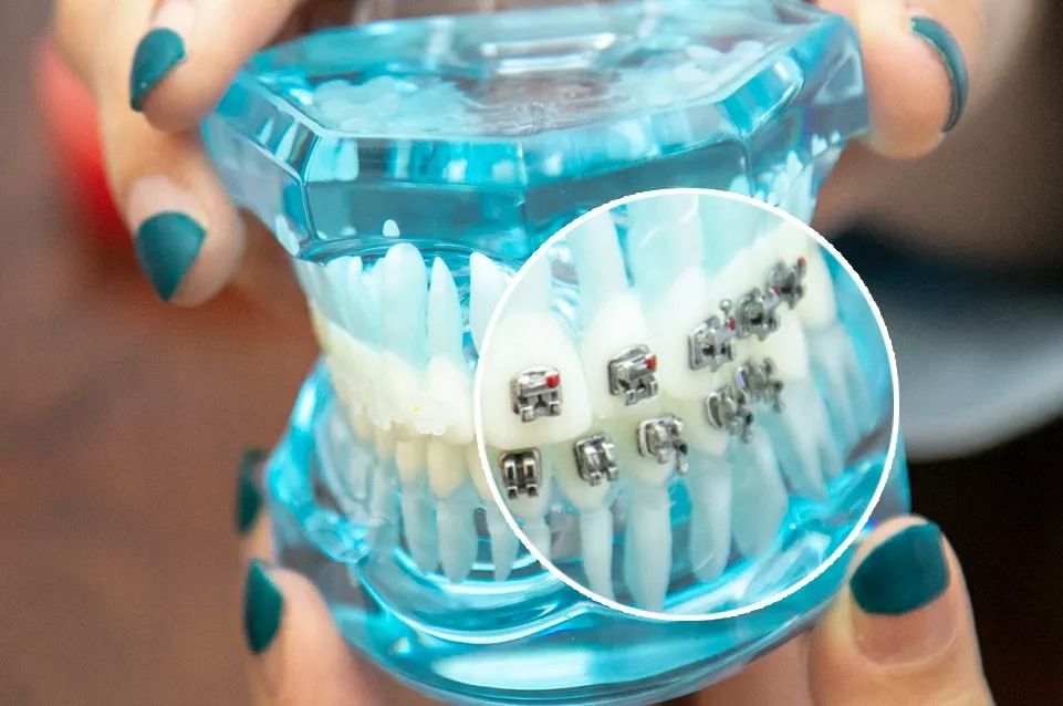 种牙免费送,种牙优惠活动免费检查是真的吗