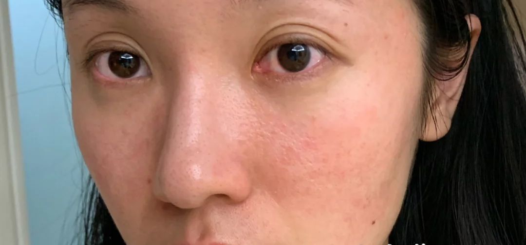 洗完脸后脸部还是能擦出脏东西,洗完脸后才知道脸上这么脏