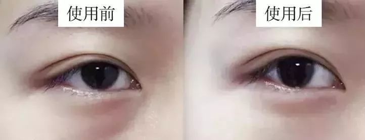 马应龙水晶眼膜视频,马应龙八宝多肽眼膜