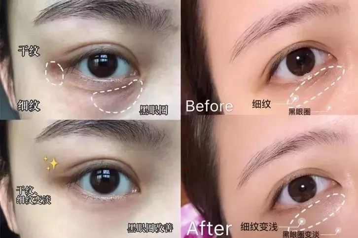 马应龙水晶眼膜视频,马应龙八宝多肽眼膜