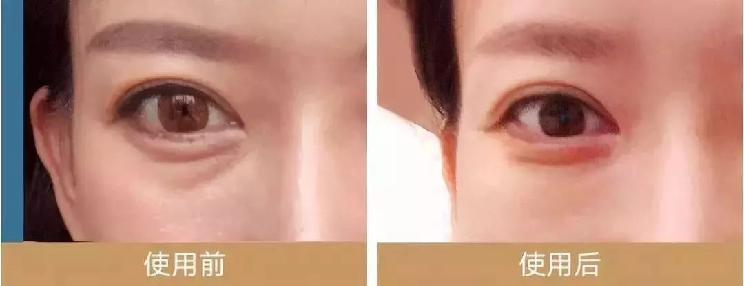 马应龙水晶眼膜视频,马应龙八宝多肽眼膜