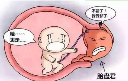 孕早期有胎盘早剥,产科医生谈怀孕变化