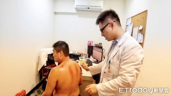 中医刮痧学关注事项,中医基础知识自学入门刮痧