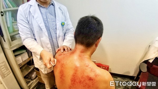 中医刮痧学关注事项,中医基础知识自学入门刮痧