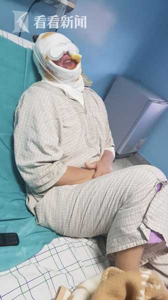 女子熟睡中惨遭毒手,熟睡烧伤女孩后续