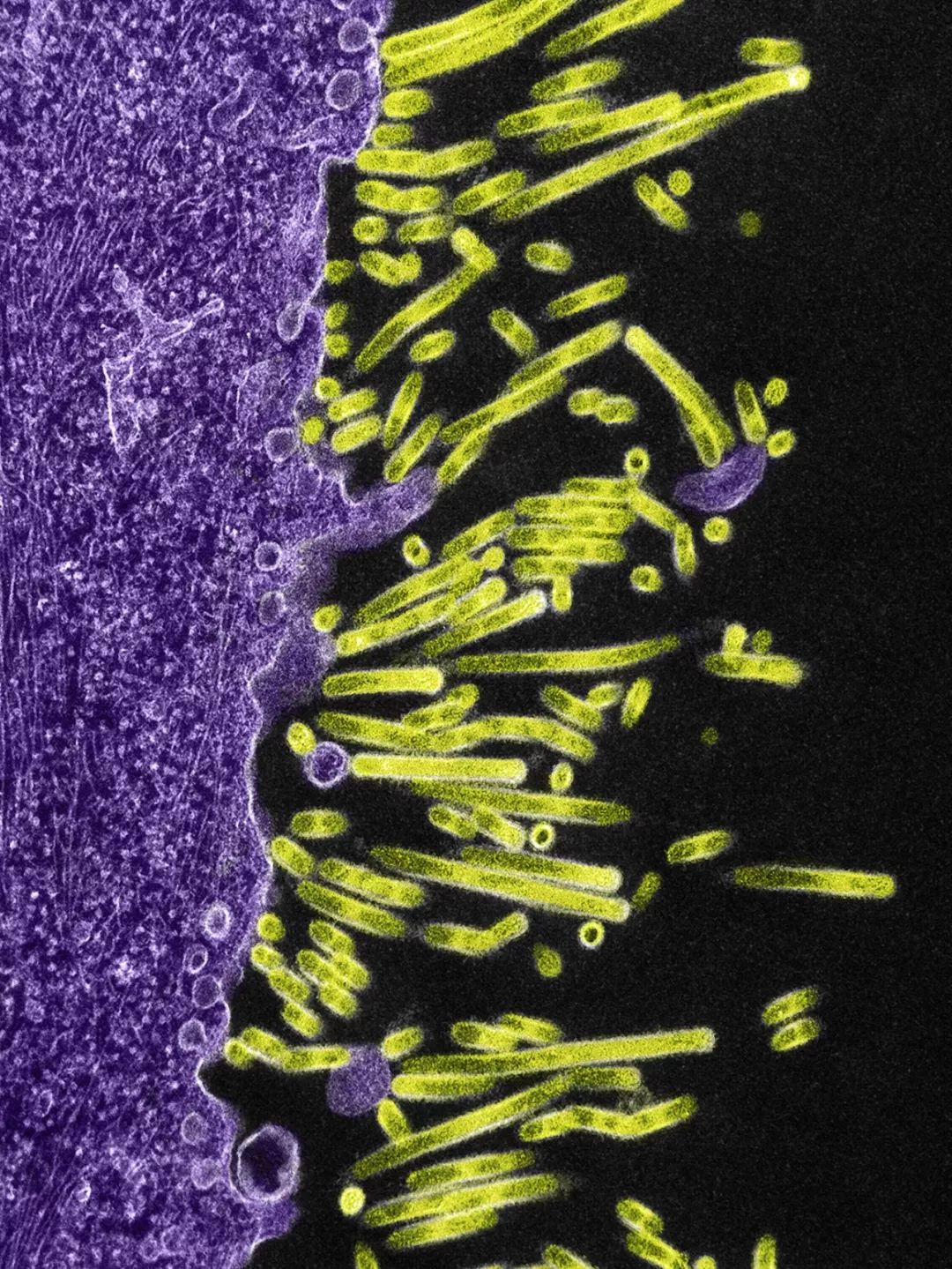 鍋囧鐥呮瘨鎰熸煋浜嗘垜,鍋囧鐥呮瘨鎰熸煋浜嗕綘