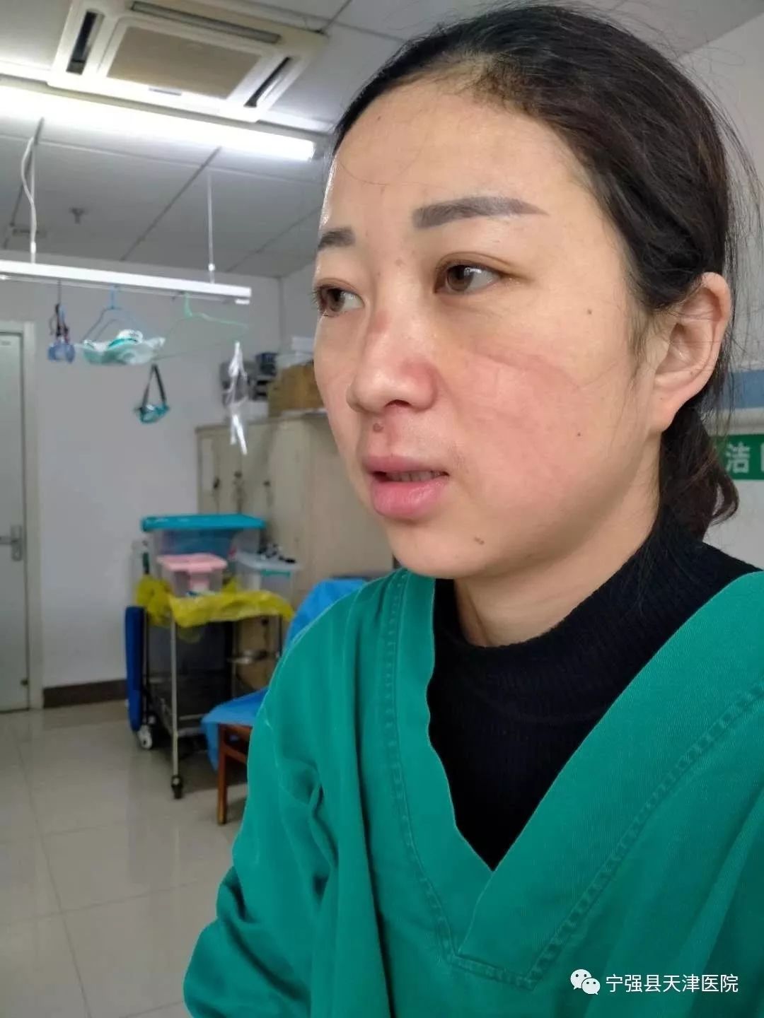 面部皮肤损伤如何快速修复,10种去除面部皮肤损伤的方法