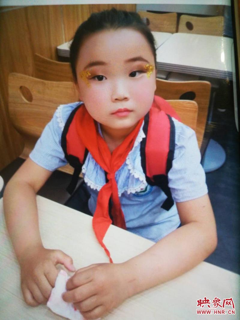 拯救生命垂危8岁女童,救救河南小女孩