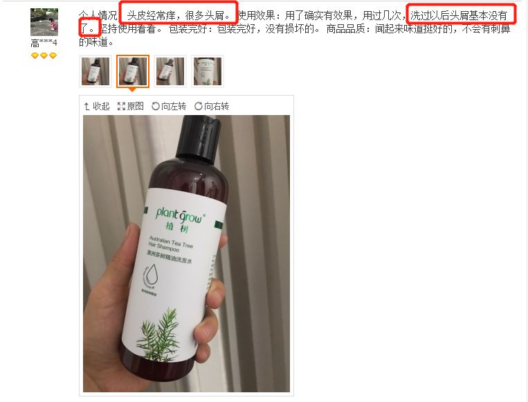 头上的螨虫用什么方法消除,头上又油又痒