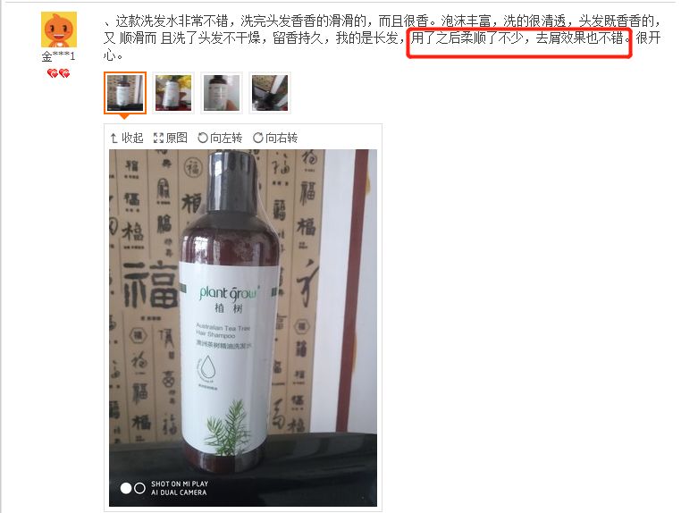 头上的螨虫用什么方法消除,头上又油又痒