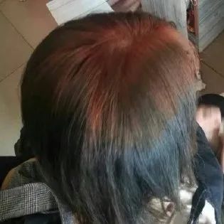 不要在家自己染发,千万不要自己在家染发