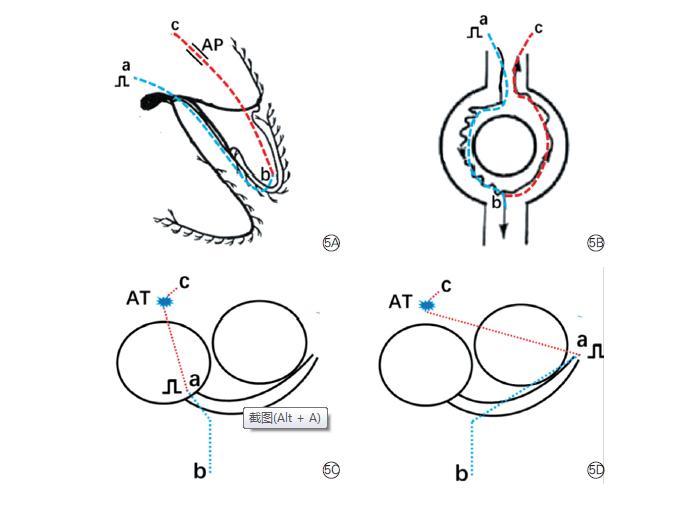 房速心电图解析,房速心电图怎么出报告