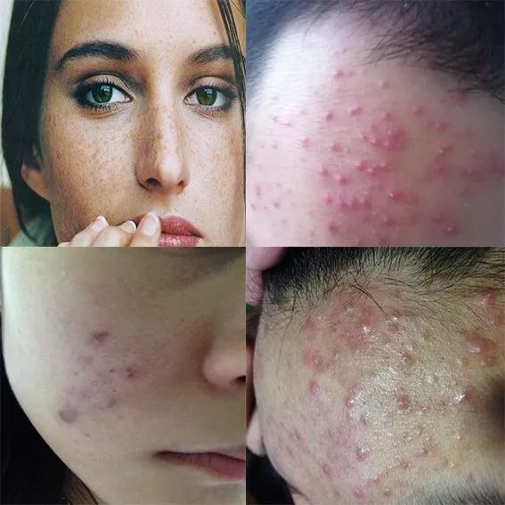 肚子上一抓一大把脂肪,肚子一抓一堆赘肉