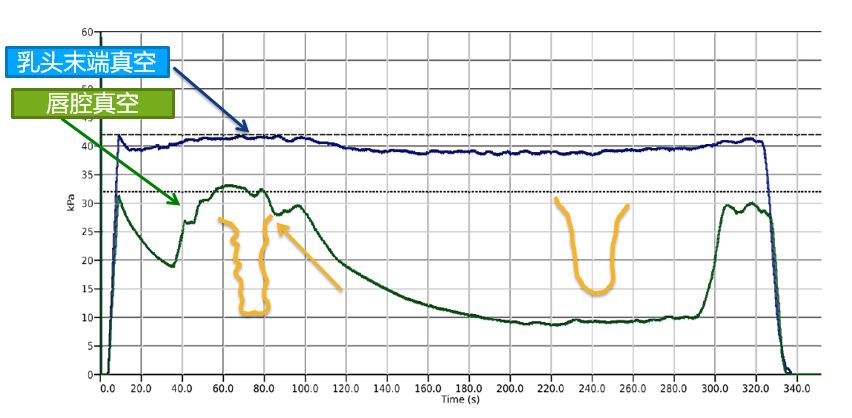 奶牛养殖技术难题及答案,奶牛接产常见问题