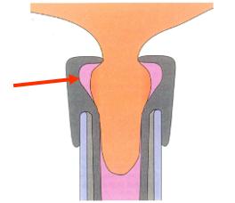 奶牛养殖技术难题及答案,奶牛接产常见问题