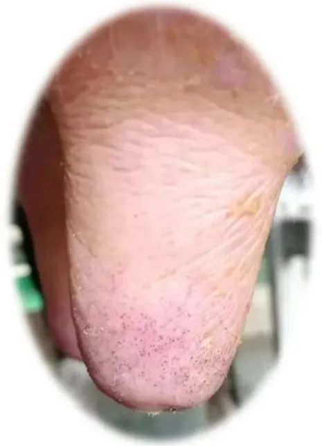 奶牛养殖技术难题及答案,奶牛接产常见问题