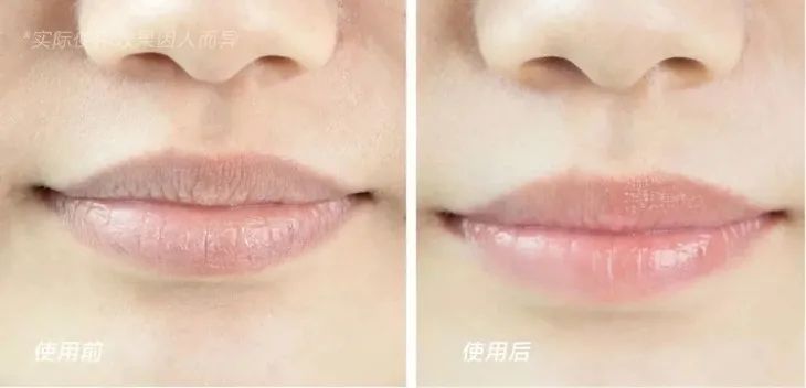 拒绝皮肤干裂带来的尴尬,唇部保养tips教程
