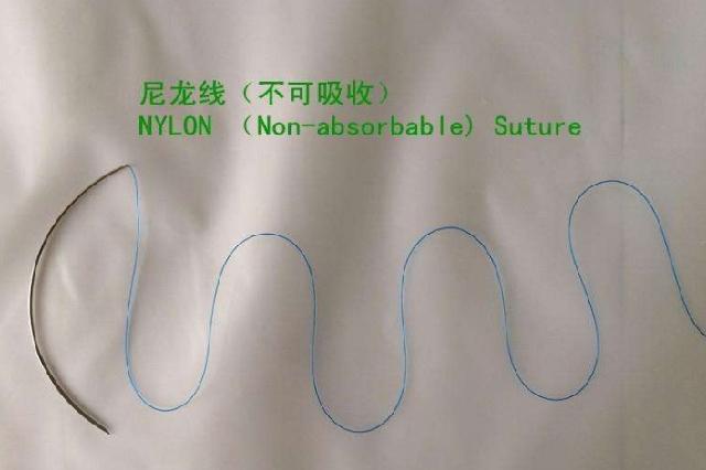 缝合伤口的线留在体内有问题吗,手术缝合线留在皮肤里怎么办