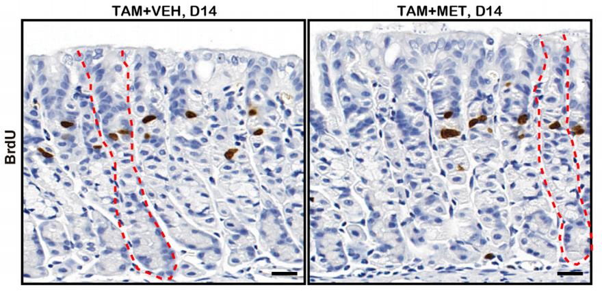 《细胞》子刊：揭示二甲双胍护胃机制！科学家发现二甲双胍可调节胃干细胞代谢，促进干细胞转化为分泌胃酸的细胞来护胃|科学大发现