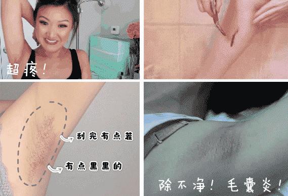 夏季脱毛用它，10分钟肌肤光滑细腻，白2度