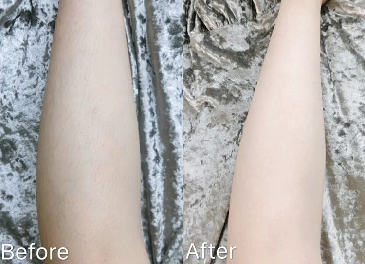 夏季脱毛用它，10分钟肌肤光滑细腻，白2度