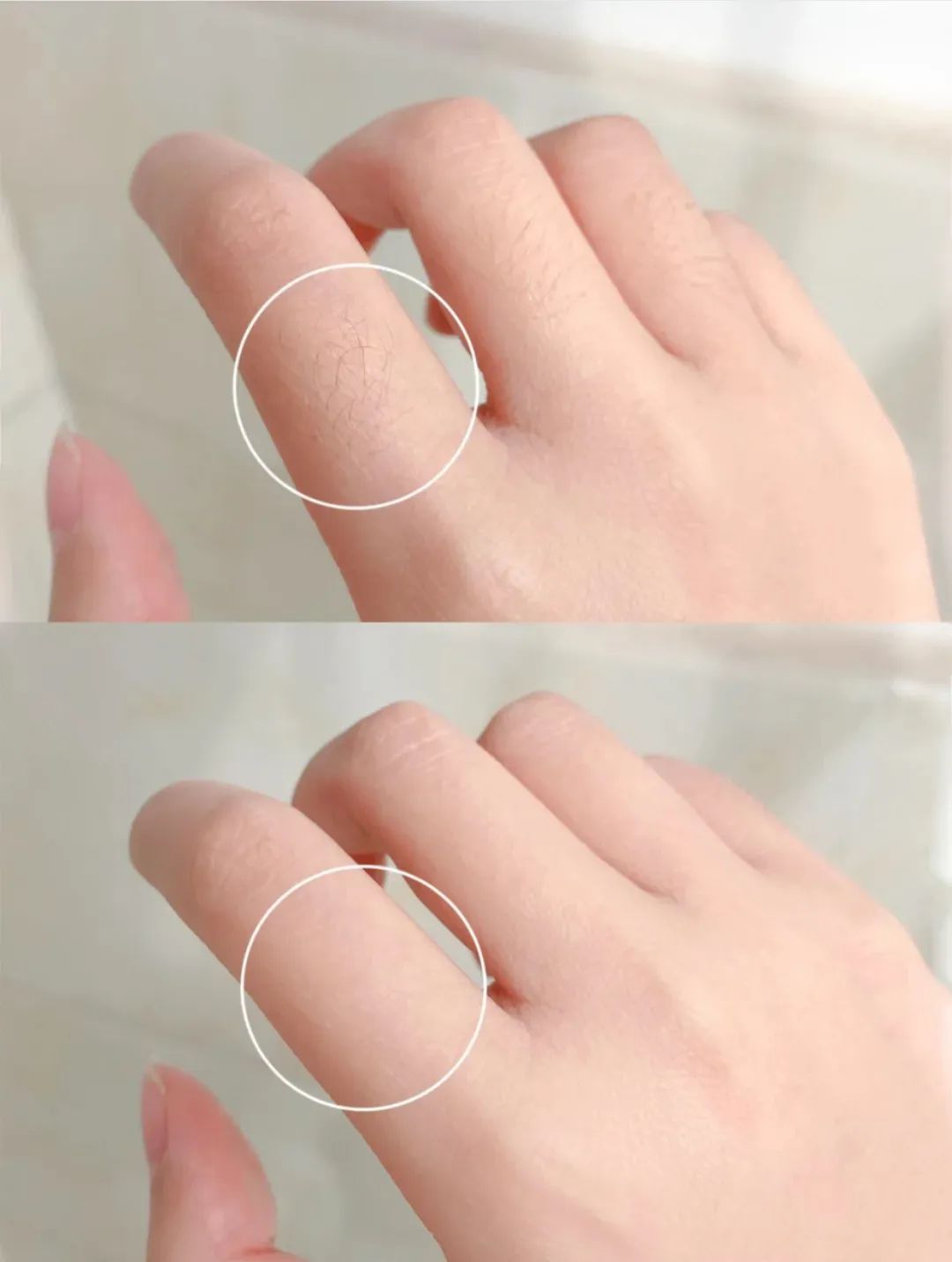 夏季脱毛用它，10分钟肌肤光滑细腻，白2度