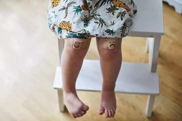 被孩子咬了需要打碎伤风针吗,被人咬破皮了需要打碎伤风针