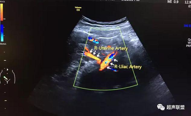 胎儿宫内窘迫如何判断,38周如何判断胎儿宫内窘迫或缺氧