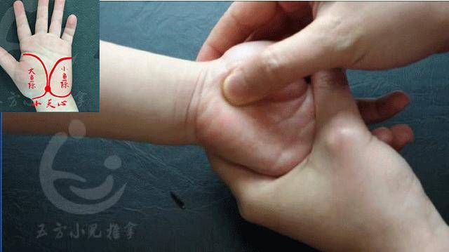 小儿口腔溃疡有特效药吗,小儿口腔溃疡能用康复新液吗