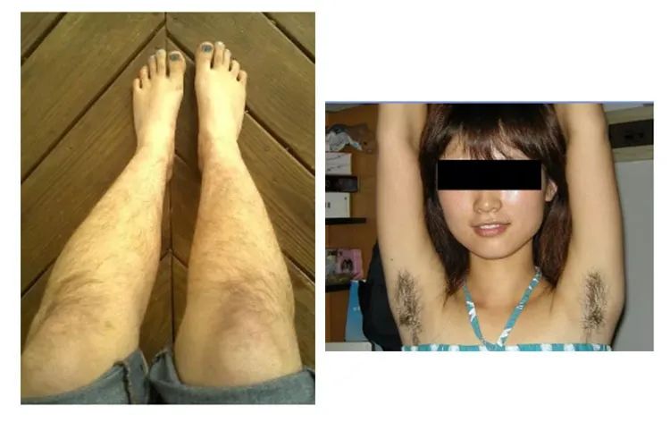 猕猴桃脱毛产品推荐,屈臣氏永久不再生毛的脱毛膏